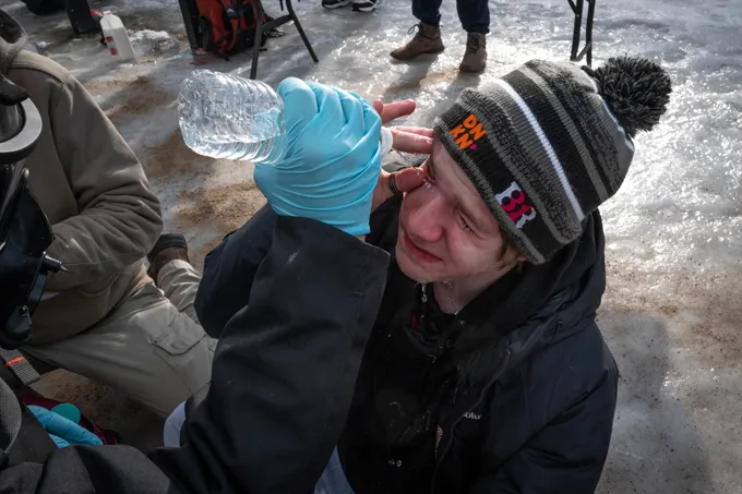 A bottle of water is squirted into a person's eye.