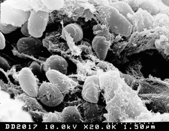 Scanning electron micrograph of Yersinia pestis bacteria