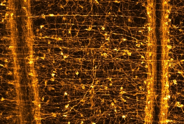 Nerve cells in gold forming the anemone's neural net