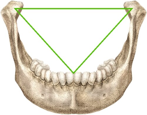 Jaw Triangle