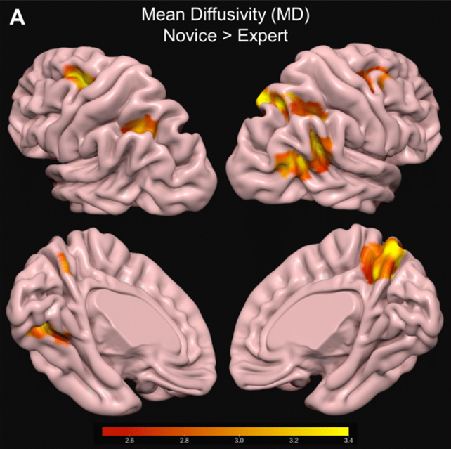 Brain scans of a birdwatcher