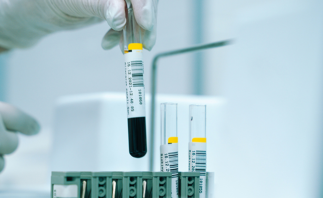 Blood test