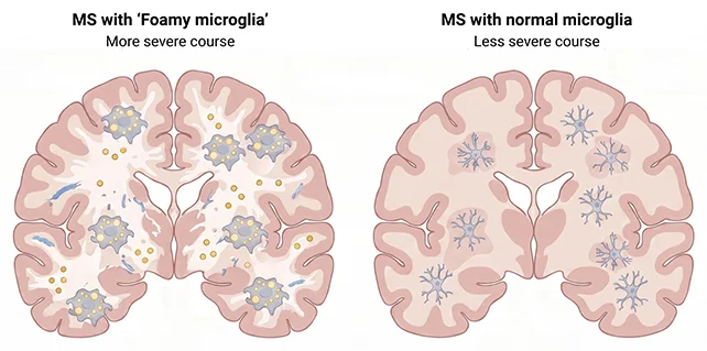 Microglia analysis