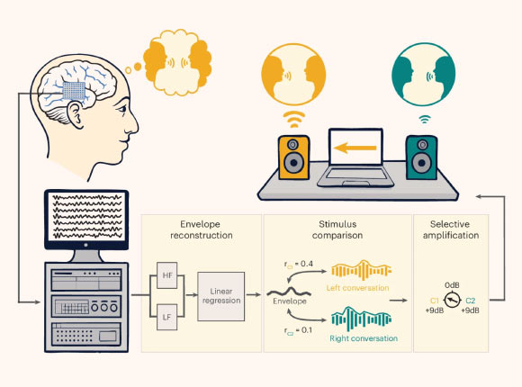 Participants with intracranial electrodes listened to two competing, spatially separated conversations. Their neural signals were recorded and fed into a real-time processing system. The system uses a linear regression model to reconstruct the temporal envelope of the attended speech from low-frequency (LF) and high-gamma (HF) neural features. The reconstructed envelope is then compared to the envelopes of the two conversations to determine the listener’s focus, which in turn drives the selective amplification of the attended speaker. Image credit: Choudhari et al., doi: 10.1038/s41593-026-02281-5.